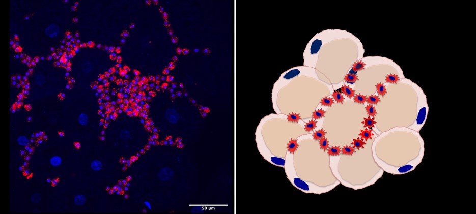 Left: schematic representation of the infiltration of immune cells in the adipose tissue of obese patients.  Right: hemocytes in the fat body of drosophila larvae