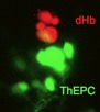Knock in of RFP into neurons of the dorsal habenula (dHb). ThEPC, thalamic early projecting cluster.