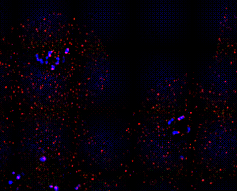 “Microscopy-based localization of RioK1 (red) at ribosomes and kinetochores in two metaphase cells. Blue: centromeres/kinetochores (CREST)”.