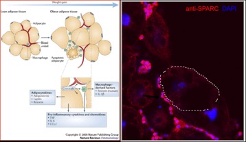 Left: schematic representation of the infiltration of immune cells in the adipose tissue of obese patients.  Right: hemocytes in the fat body of drosophila larvae